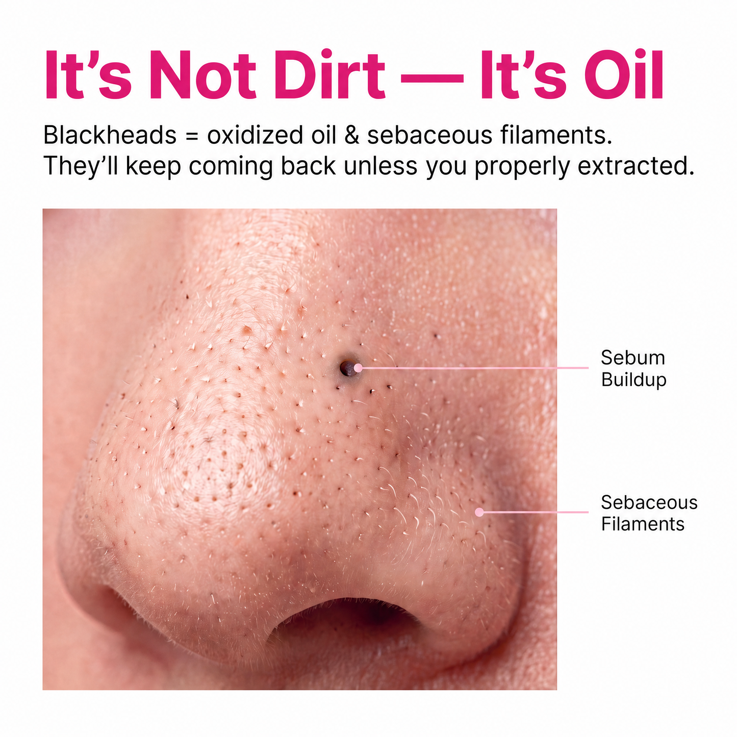 Pore Cleanser